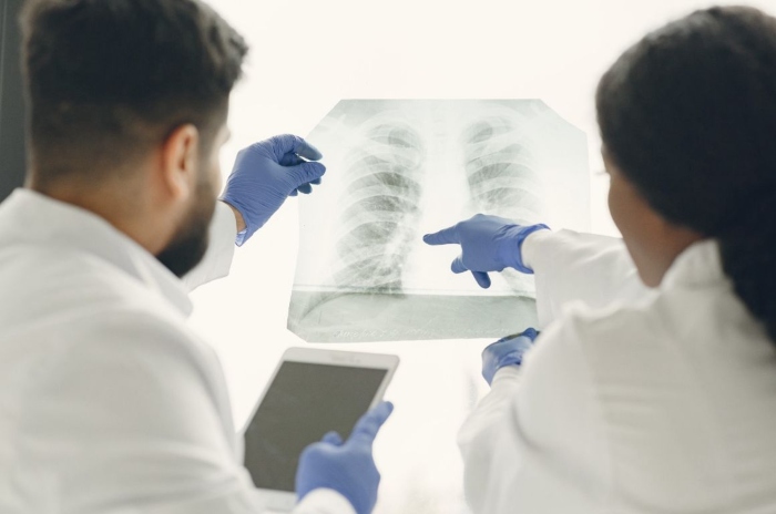 prevención- cáncer pulmón- Instituto Nacional de Cancerología-